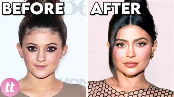90 Day Fiance star Natalie's before and after plastic surgery pictures explored