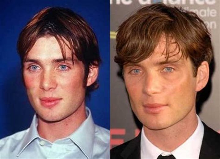 Cillian Murphy Nose: Did He Underwent Surgery? Before And After Pics