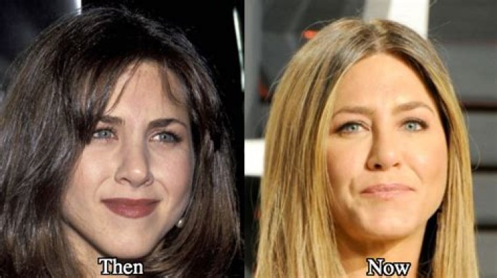 Jennifer Aniston Nose Job And Plastic Surgery Before And After Photos