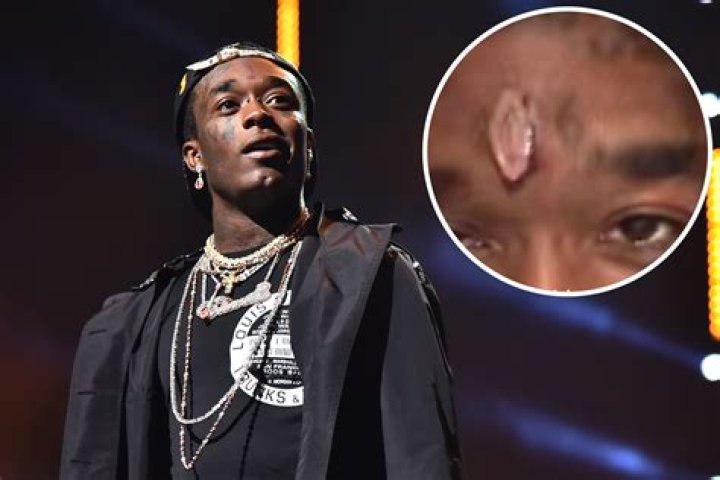 Lil Uzi Vert's Diamond Implant Is Inspired By This Rapper ·
