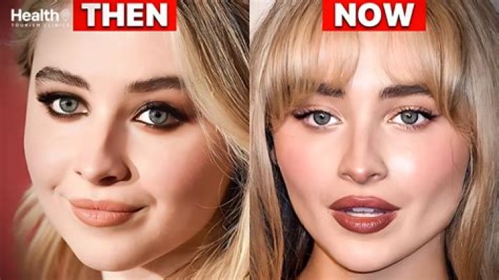 Sabrina Carpenter's Plastic Surgery Rumors: Fact Or Fiction?