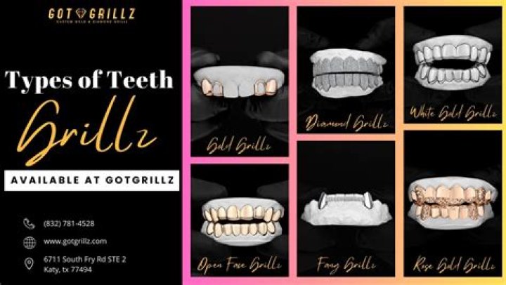 Unveiling The Allure Of Grillz: Discoveries And Insights